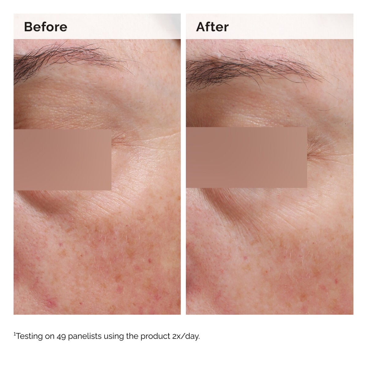 niacinamide-5-face-and-body-emulsion-f1 2024-08-23-ORD-Nia-5pct-Face-Body-B-A-Elasticity-Global-02-1x1.jpg