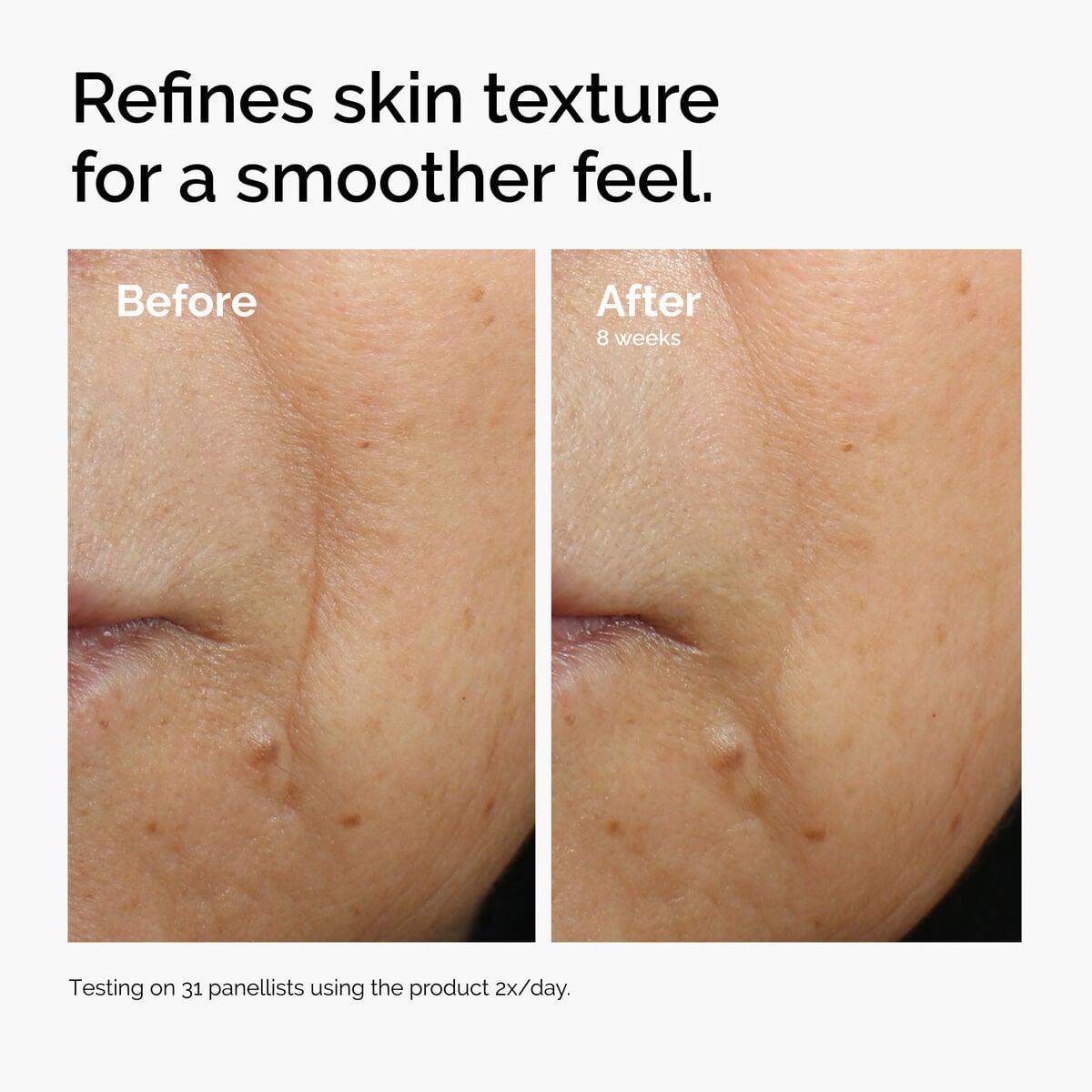 caffeine-3-escin-1-face-serum-x8 ord-caffeine-3pct-escin-1pct-face-serum-before-after-texture.jpg
