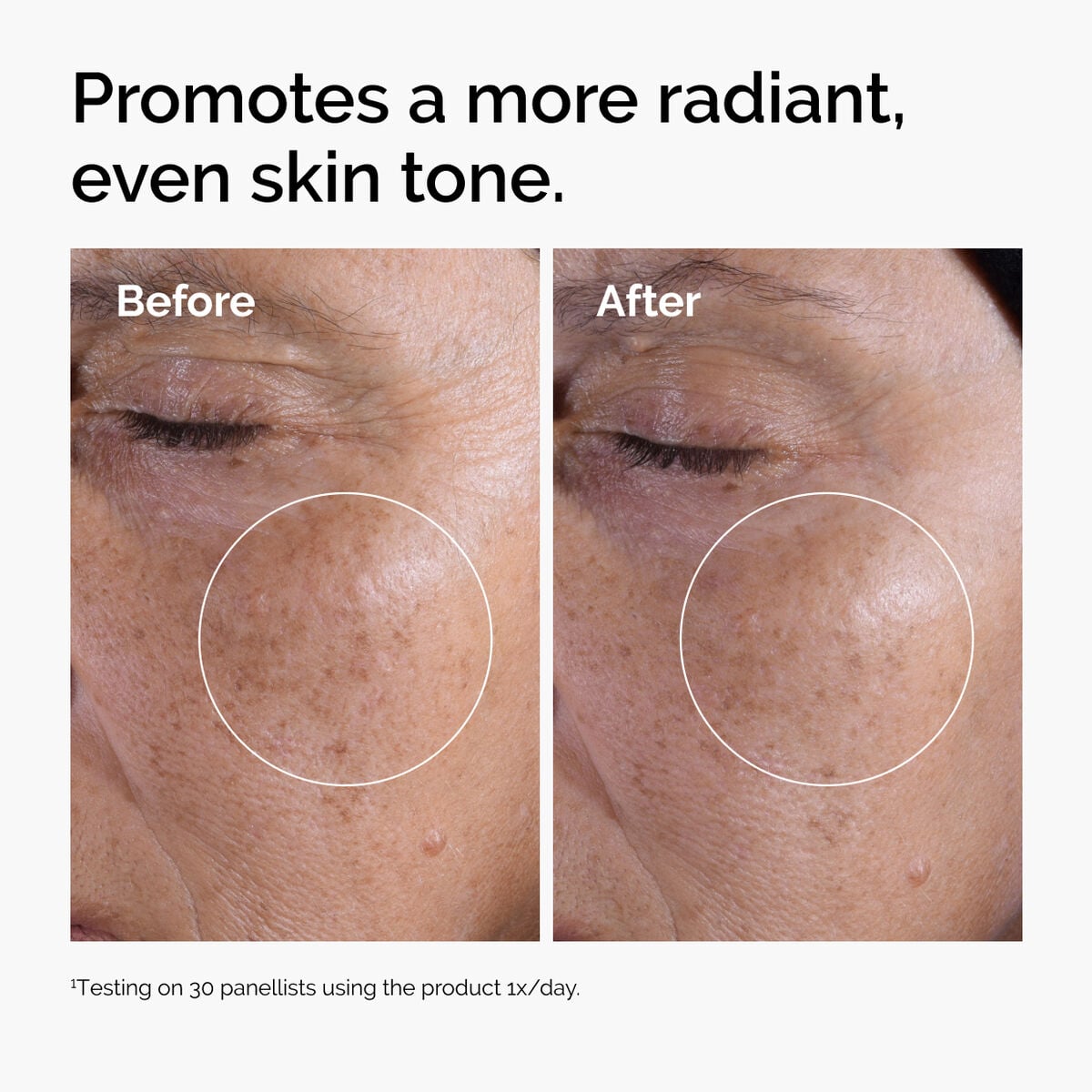 glycolic-acid-7-exfoliating-toner-x6 ord-glycolic-before-after-radiance.jpg